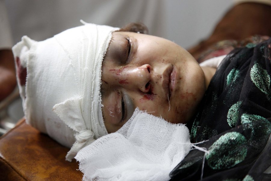epa04996961 A girl who was injured in a 7.7 magnitude earthquake, receives medical treatment at a hospital in Peshawar, Pakistan, 26 October 2015. A strong earthquake with a magnitude of 7.7 hit northern Afghanistan's Hindu Kush mountain range causing damage in Pakistan and India as well. At least 69 people were killed in Pakistan, 20 in Afghanistan and hundreds wounded. Tremors were felt in northern India including the capital New Delhi, causing thousands of people to evacuate buildings. Authorities also closed the underground train system. EPA/ARSHAD ARBAB