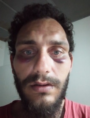 Κρήτη: Καταγγέλλει ότι τον ξυλοκόπησαν αστυνομικοί γιατί τον πέρασαν για Πακιστανό