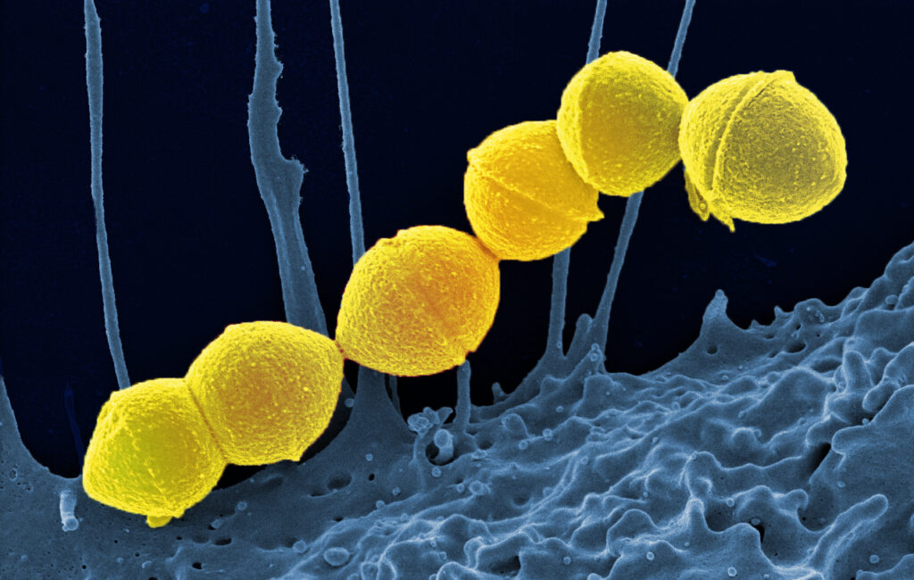 streptococcus pyogenes group a strep 52602981880 1